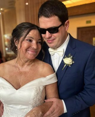 Me casé con un hombre ciego para que nunca viera mis cicatrices. En nuestra noche de bodas, me dijo: “Tienes que saber la verdad que he estado ocultando durante 20 años”.