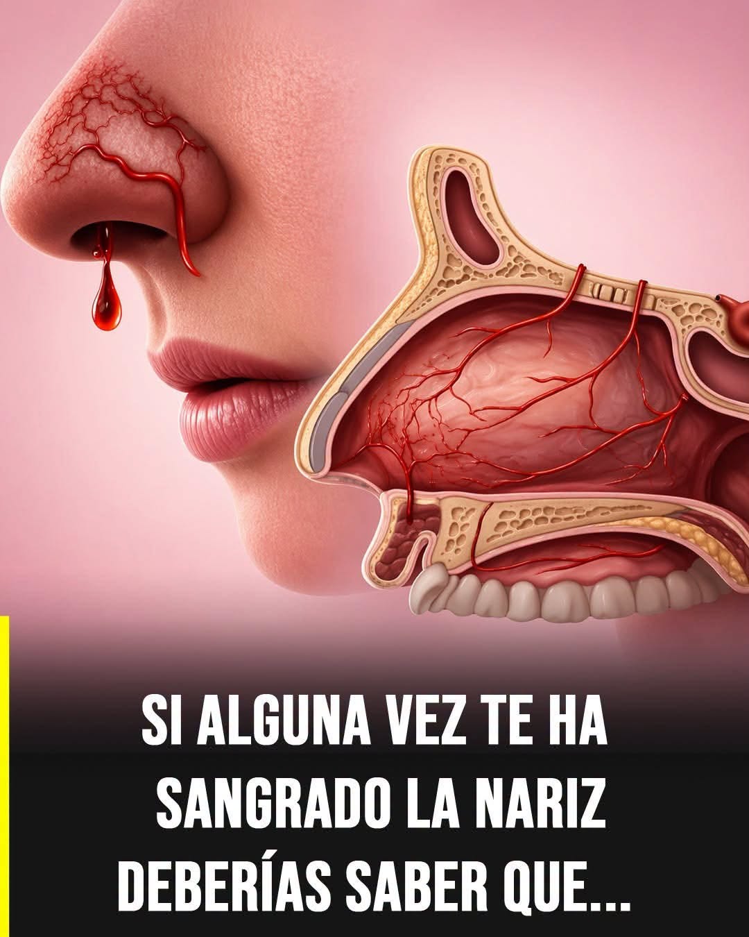 Sangrado nasal: causas frecuentes y señales de alerta que no debes ignorar