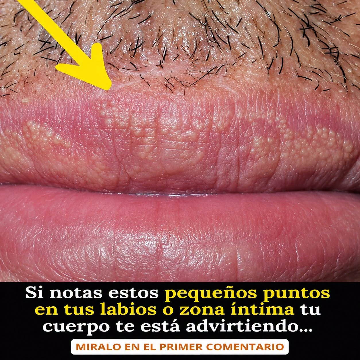 Si te están saliendo estos granitos en tus labios o zona intima