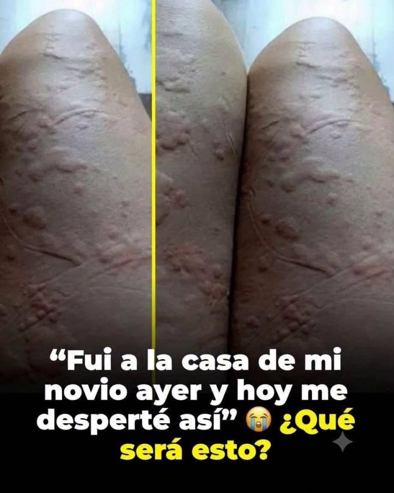 ¿Alergia o moretón? Por qué una fotografía no permite saber qué ocurrió realmente