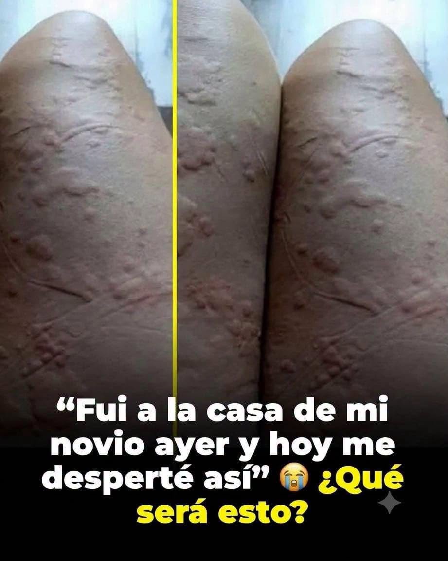 ¿Alergia o moretón? Por qué una fotografía no permite saber qué ocurrió realmente