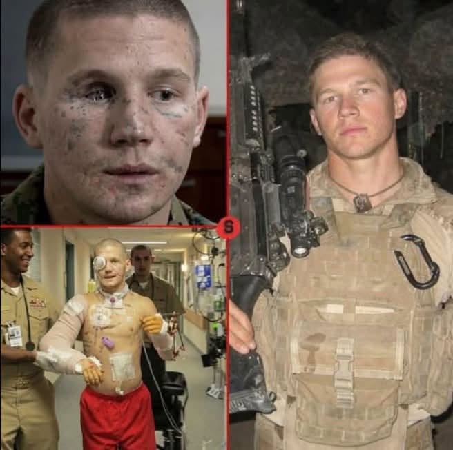 Kyle Carpenter: el marine que se lanzó hacia una granada para salvar a su compañero
