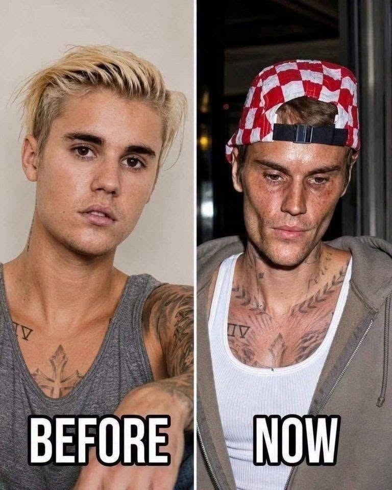 🥺Justin Bieber admits that he tested positive for…